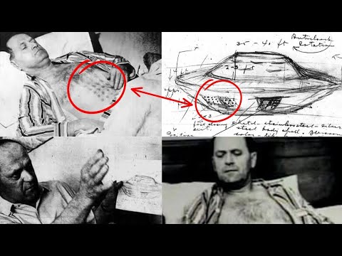 Stefan Michalak: The Man Burned by a UFO at Falcon Lake